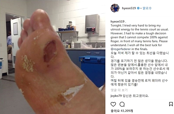 <정현 선수가 중계 중 드러낸 왼발이 아닌 오른발의 상태와 소감을 SNS에 공개했다. 이미지=정현 선수 SNS에서 갈무리>